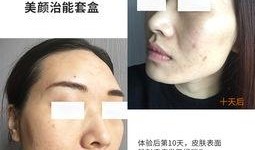 西班牙肌肤在线观看,揭秘西班牙护肤秘籍